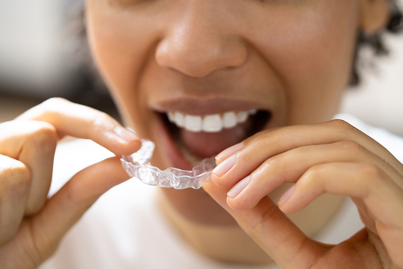 Straighten Your Smile This Summer with Invisalign®