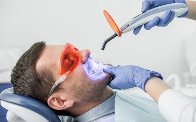 7 Tips to Make Your Tooth Whitening Results Last