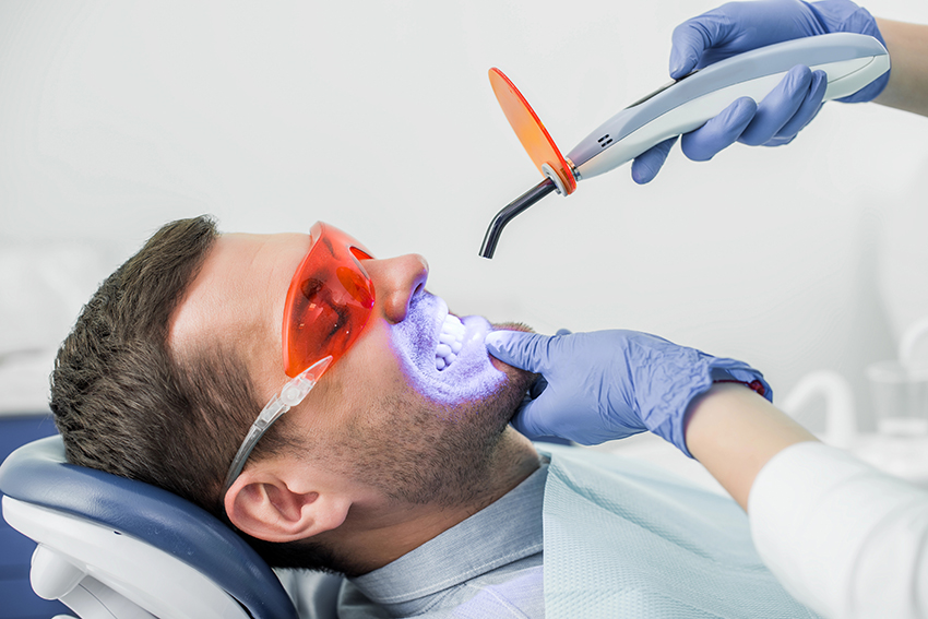 7 Tips to Make Your Tooth Whitening Results Last