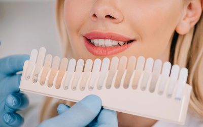Who Should Get Tooth Whitening? Here’s Why It Might Be Right for You