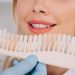Who Should Get Tooth Whitening? Here’s Why It Might Be Right for You