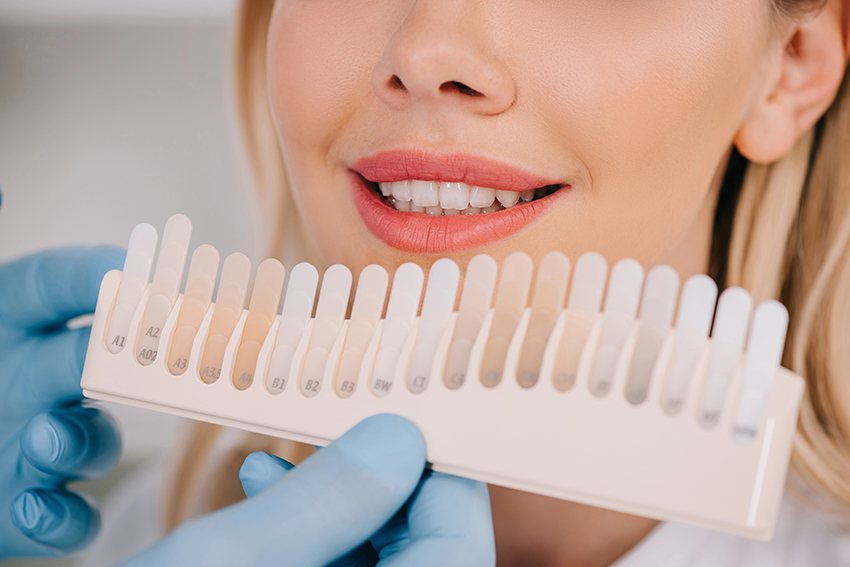 Who Should Get Tooth Whitening? Here’s Why It Might Be Right for You