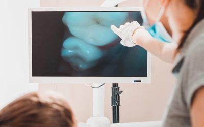 How to Care for Composite Fillings After Treatment (And Make Them Last)