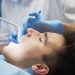 Composite Fillings: 8 Common Questions Patients Ask Before Treatment